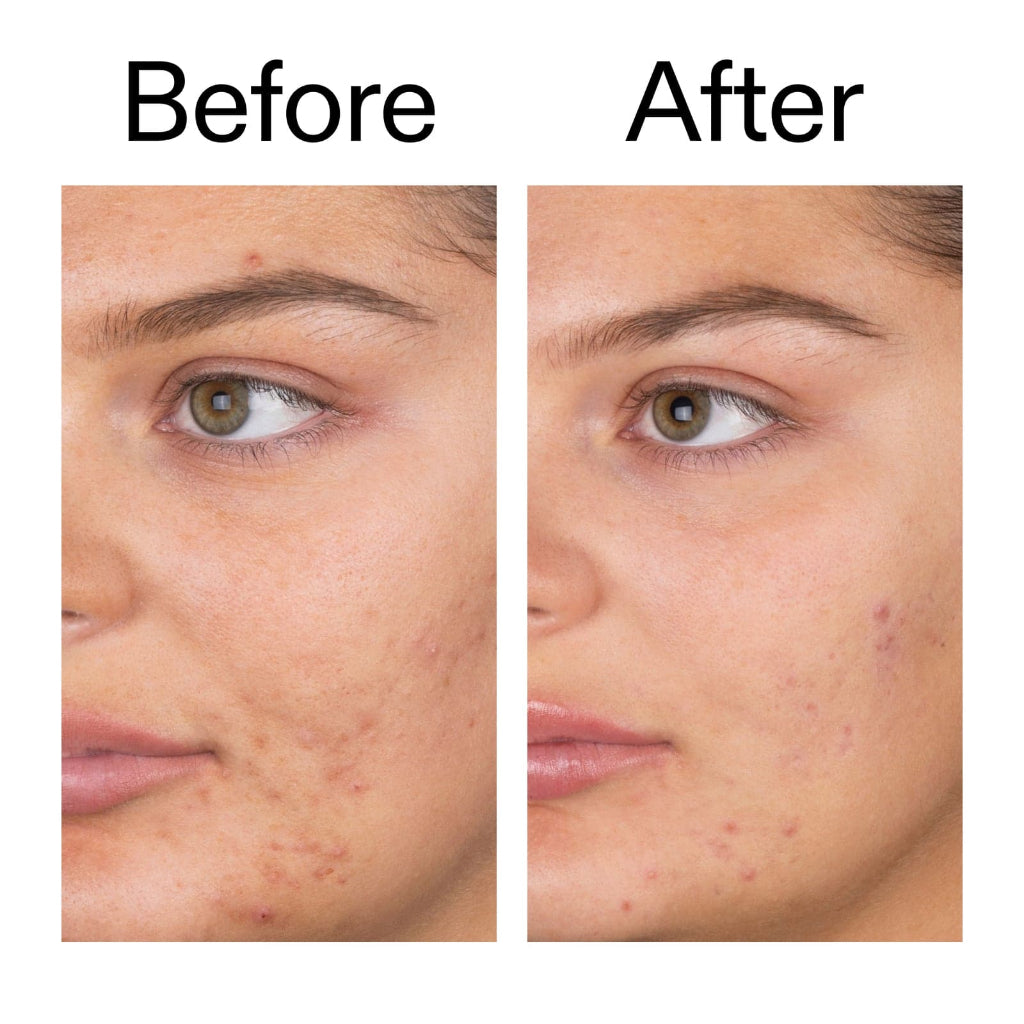 The INKEY List Cleanser – Salicylic Acid Cleanser - 150 ml - Certified from TheINKEYList