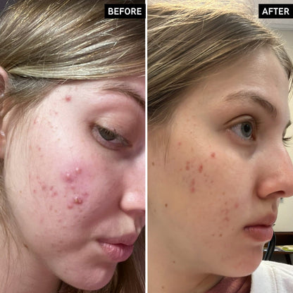 The INKEY List Cleanser – Salicylic Acid Cleanser - 150 ml - Certified from TheINKEYList